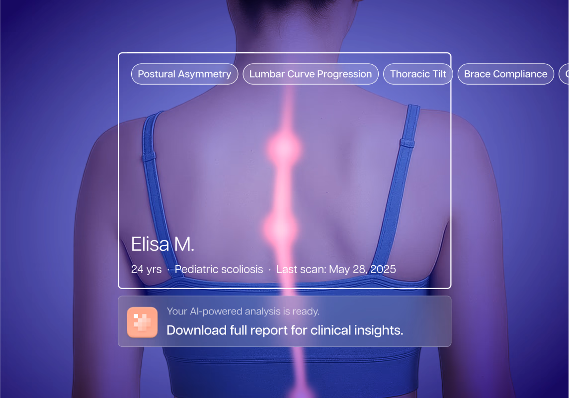 A MOMENTUM SHIFT IN SCOLIOSIS CARE